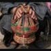 Kangri cancer cases on the rise in Kashmir