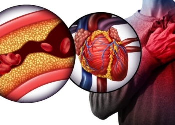 Sensitivity to common food may significantly up risk of heart disease: Study