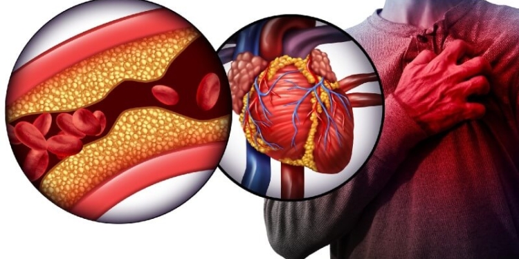Sensitivity to common food may significantly up risk of heart disease: Study