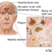 Roadway Air Pollution could accelerate Alzheimer’s Plaque formation