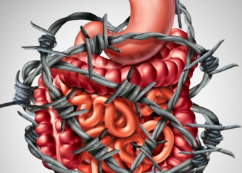 Irritable Bowel Syndrome: Why are young adults at high risk?