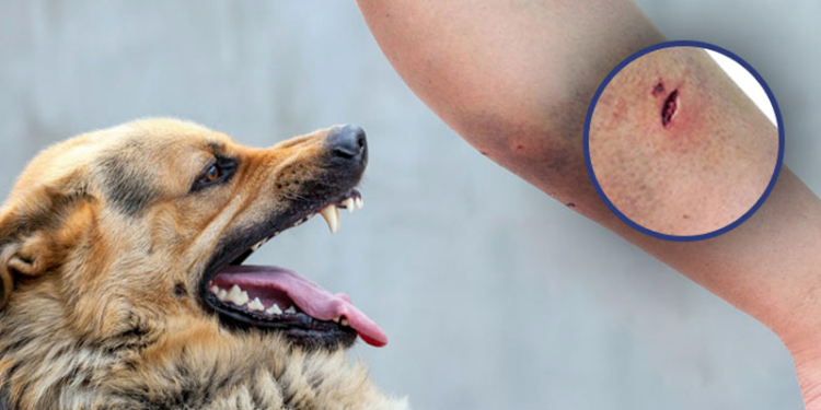 J&K Govt Forms UT, District Committees to Implement Supreme Court’s Stray Dog Management Rules: Schools, Hospitals, Railway Stations to Be Cleared